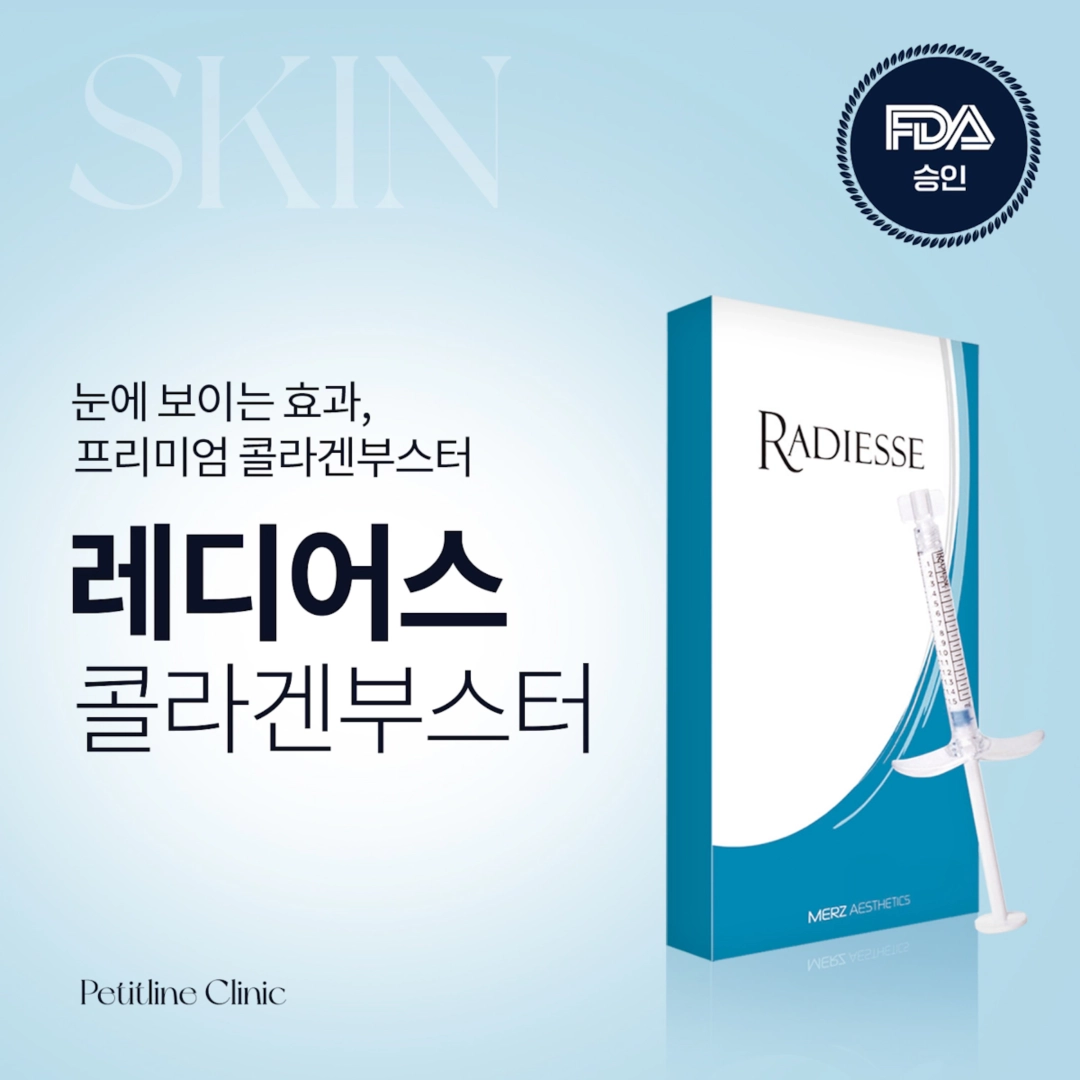 즉각적인 볼륨과 자가 콜라겐 생성을 동시에, 레디어스(Radiesse) 콜라겐 효과 및 부작용